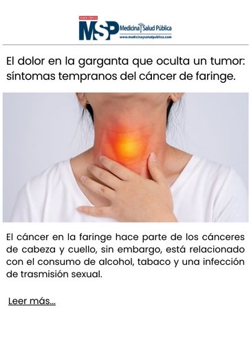El dolor en la garganta que oculta un tumor síntomas tempranos del cáncer de faringe.