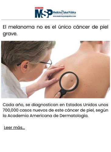 El melanoma no es el único cáncer de piel grave.