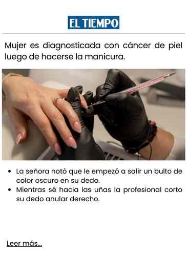 Mujer es diagnosticada con cáncer de piel luego de hacerse la manicura.