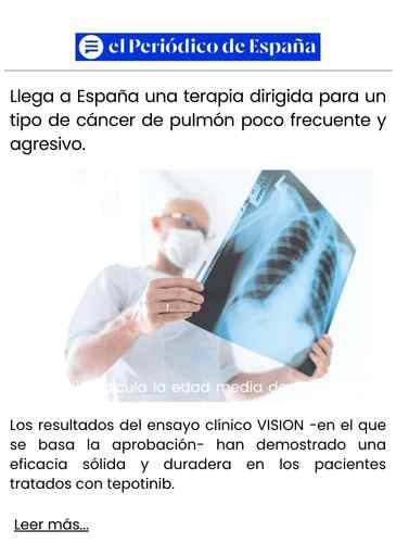 Llega a España una terapia dirigida para un tipo de cáncer de pulmón poco frecuente y agresivo.