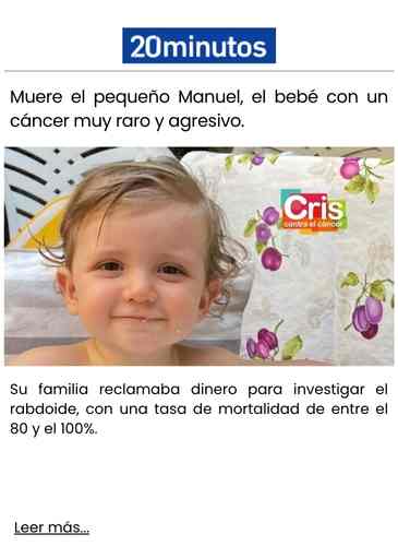 Muere el pequeño Manuel, el bebé con un cáncer muy raro y agresivo.