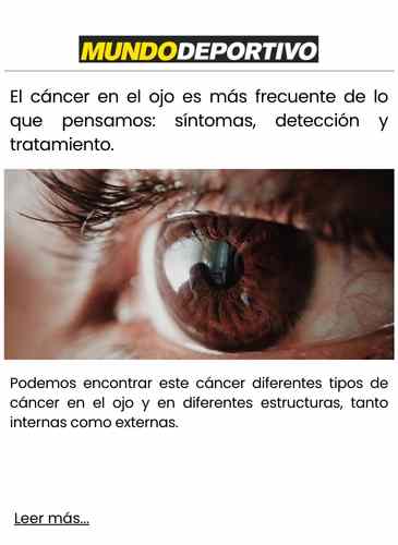 El cáncer en el ojo es más frecuente de lo que pensamos síntomas, detección y tratamiento.