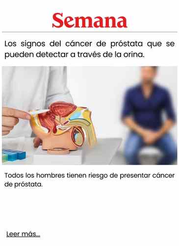 Los signos del cáncer de próstata que se pueden detectar a través de la orina.