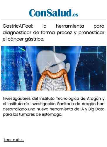 GastricAITool la herramienta para diagnosticar de forma precoz y pronosticar el cáncer gástrico.