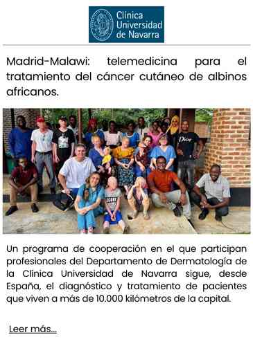 Madrid-Malawi telemedicina para el tratamiento del cáncer cutáneo de albinos africanos.