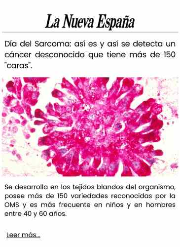 Día del Sarcoma así es y así se detecta un cáncer desconocido que tiene más de 150 caras.