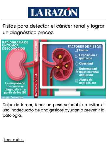 Pistas para detectar el cáncer renal y lograr un diagnóstico precoz.