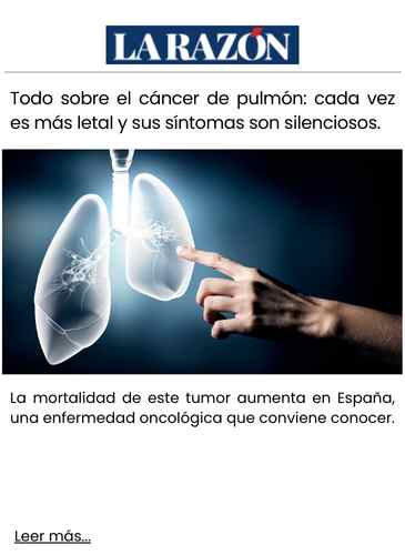 Todo sobre el cáncer de pulmón cada vez es más letal y sus síntomas son silenciosos.